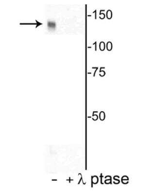 Western Blot DENND3 [p Thr450] Antibody